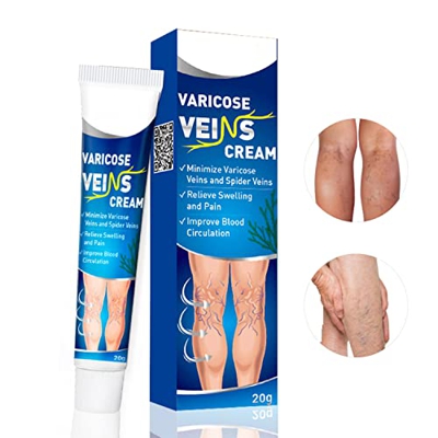 Utapossin Tratamiento De Las Arañas Vasculares, Crema Para Arañas Vasculares En Las Piernas, Crema Para Varices Y Piernas Cansadas E Inflamadas, Cuida
